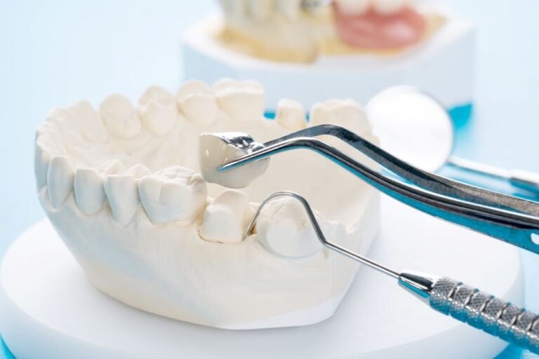 dental crowns for kids in springboro, oh