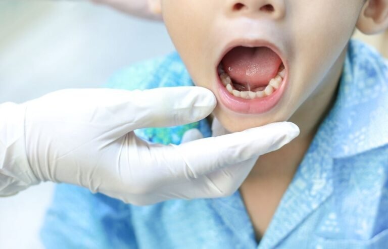 tongue-tie treatment for kids near you